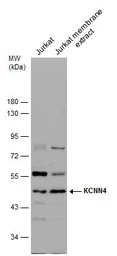 Anti-KCNN4 antibody used in Western Blot (WB). GTX130239