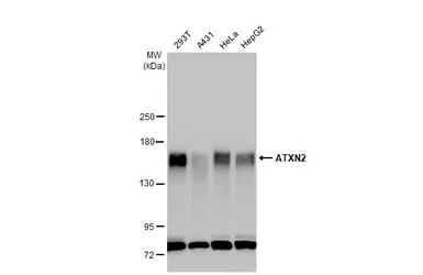 Anti-ATXN2 antibody used in Western Blot (WB). GTX130329