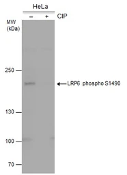 Anti-LRP6 (phospho Ser1490) antibody used in Western Blot (WB). GTX130421