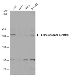 Anti-LRP6 (phospho Ser1490) antibody used in Western Blot (WB). GTX130421