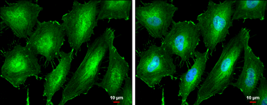 Anti-PKC alpha antibody used in Immunocytochemistry/ Immunofluorescence (ICC/IF). GTX130453