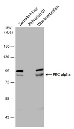 Anti-PKC alpha antibody used in Western Blot (WB). GTX130453