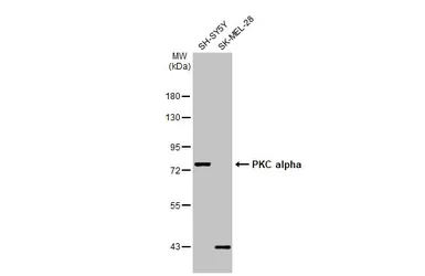 Anti-PKC alpha antibody used in Western Blot (WB). GTX130453