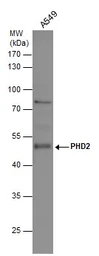 Anti-PHD2 antibody used in Western Blot (WB). GTX130482