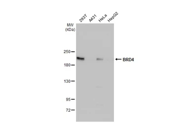 Anti-BRD4 antibody used in Western Blot (WB). GTX130586