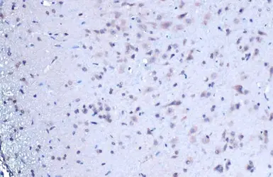 Anti-BRD4 antibody used in IHC (Paraffin sections) (IHC-P). GTX130586