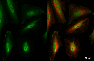 Anti-BRD4 antibody used in Immunocytochemistry/ Immunofluorescence (ICC/IF). GTX130586