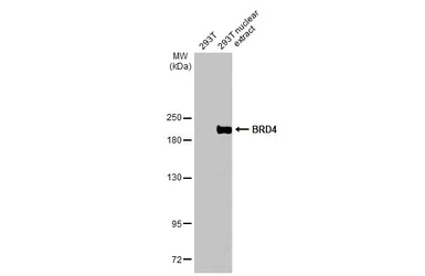 Anti-BRD4 antibody used in Western Blot (WB). GTX130586