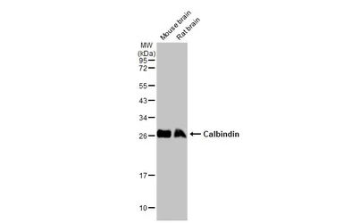 Anti-Calbindin antibody used in Western Blot (WB). GTX130856