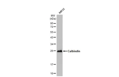 Anti-Calbindin antibody used in Western Blot (WB). GTX130856