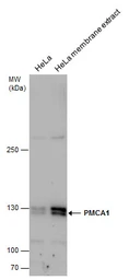 Anti-PMCA1 antibody used in Western Blot (WB). GTX130858