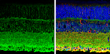 Anti-PMCA1 antibody used in IHC (Paraffin sections) (IHC-P). GTX130858