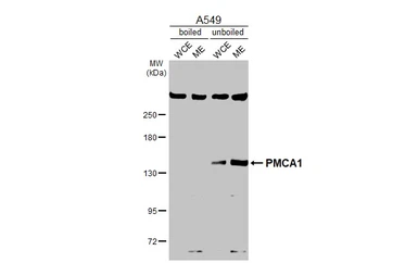 Anti-PMCA1 antibody used in Western Blot (WB). GTX130858