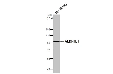 Anti-ALDH1L1 antibody used in Western Blot (WB). GTX131047