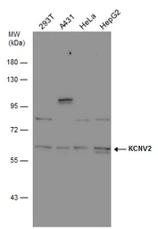 Anti-KCNV2 antibody used in Western Blot (WB). GTX131149