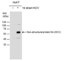 Anti-Hepatitis C virus NS5A protein antibody used in Western Blot (WB). GTX131272