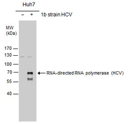 Anti-Hepatitis C virus NS5B protein antibody used in Western Blot (WB). GTX131274