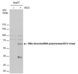 Anti-Hepatitis C virus NS5B protein antibody used in Western Blot (WB). GTX131274