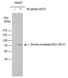 Anti-Hepatitis C virus NS3 protein antibody used in Western Blot (WB). GTX131276