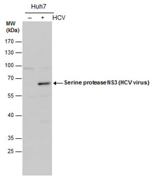 Anti-Hepatitis C virus NS3 protein antibody used in Western Blot (WB). GTX131276