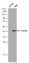 Anti-CD79a antibody used in Western Blot (WB). GTX131291