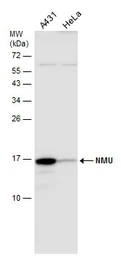 Anti-NMU antibody used in Western Blot (WB). GTX131391