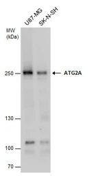 Anti-ATG2A antibody used in Western Blot (WB). GTX131503