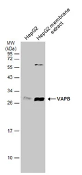 Anti-VAPB antibody used in Western Blot (WB). GTX131631