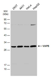 Anti-VAPB antibody used in Western Blot (WB). GTX131631