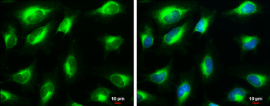 Anti-VAPB antibody used in Immunocytochemistry/ Immunofluorescence (ICC/IF). GTX131631