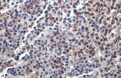 Anti-PARP14 antibody used in IHC (Paraffin sections) (IHC-P). GTX131920