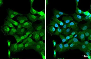 Anti-PARP14 antibody used in Immunocytochemistry/ Immunofluorescence (ICC/IF). GTX131920