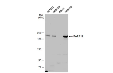 Anti-PARP14 antibody used in Western Blot (WB). GTX131920