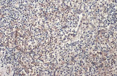 Anti-PARP14 antibody used in IHC (Paraffin sections) (IHC-P). GTX131920