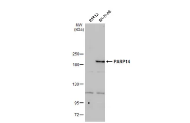 Anti-PARP14 antibody used in Western Blot (WB). GTX131920