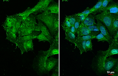 Anti-PARP14 antibody used in Immunocytochemistry/ Immunofluorescence (ICC/IF). GTX131920