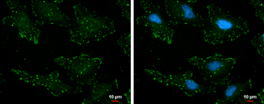 Anti-p130Cas (phospho Tyr165) antibody used in Immunocytochemistry/ Immunofluorescence (ICC/IF). GTX132160