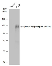 Anti-p130Cas (phospho Tyr165) antibody used in Western Blot (WB). GTX132160