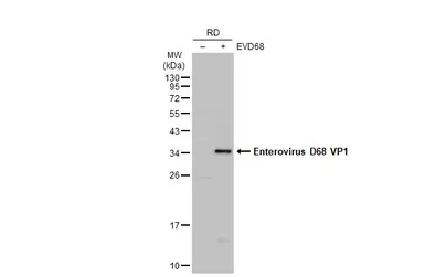 Anti-Enterovirus D68 VP1 antibody used in Western Blot (WB). GTX132313