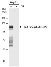 Anti-FAK (phospho Tyr407) antibody used in Western Blot (WB). GTX132320