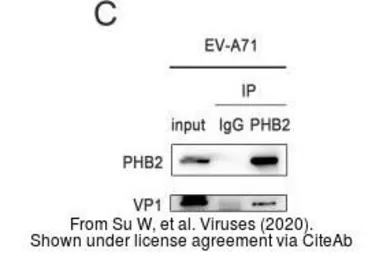 Anti-Enterovirus 71 VP1 antibody used in Western Blot (WB). GTX132339