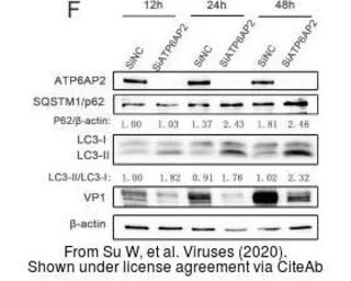 Anti-Enterovirus 71 VP1 antibody used in Western Blot (WB). GTX132339