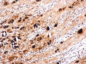 Anti-Enterovirus 71 VP1 antibody used in IHC (Paraffin sections) (IHC-P). GTX132339