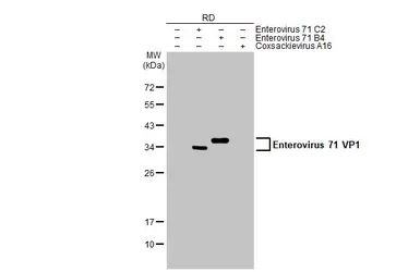 Anti-Enterovirus 71 VP1 antibody used in Western Blot (WB). GTX132339