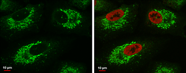 Anti-Glutaminase C (GAC) antibody used in Immunocytochemistry/ Immunofluorescence (ICC/IF). GTX132402