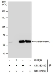 Anti-Glutaminase C (GAC) antibody used in Immunoprecipitation (IP). GTX132402