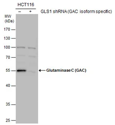 Anti-Glutaminase C (GAC) antibody used in Western Blot (WB). GTX132402