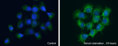 Anti-WIPI2 antibody used in Immunocytochemistry/ Immunofluorescence (ICC/IF). GTX132453