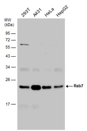 Anti-RAB7A antibody used in Western Blot (WB). GTX132548