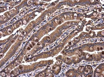 Anti-RAB7A antibody used in IHC (Paraffin sections) (IHC-P). GTX132548